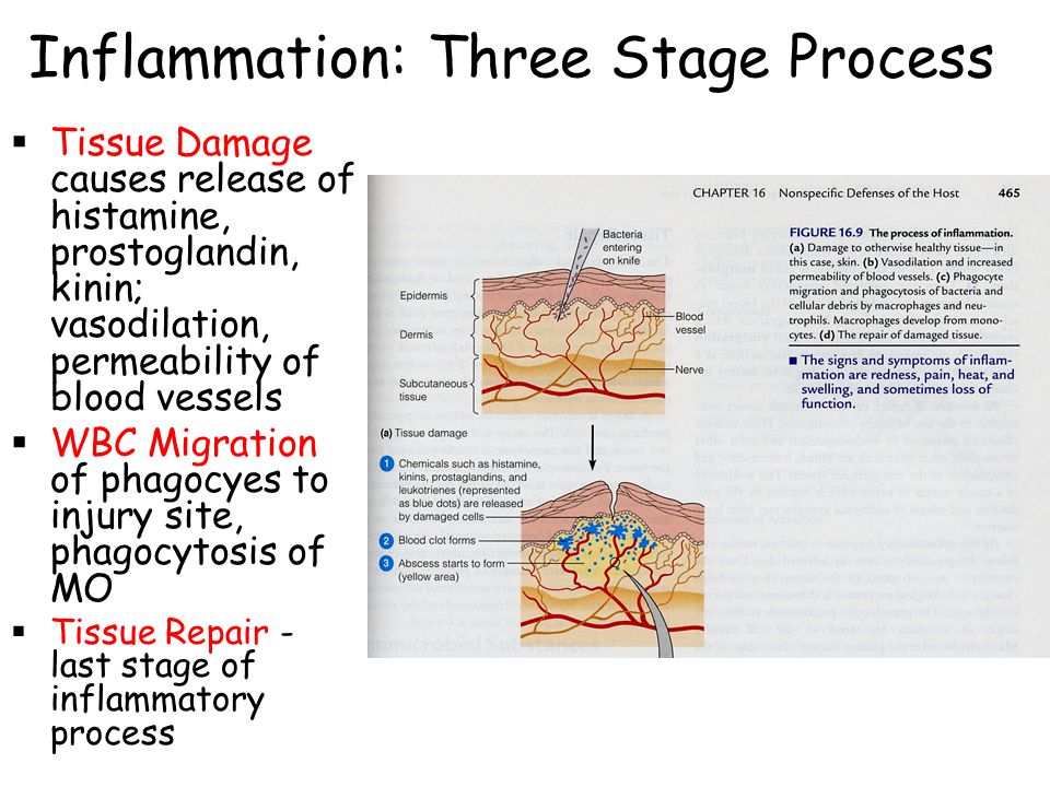 Triple response process of inflammation